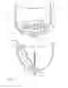 Fig. 07 - LAMP DEVICE AND METHOD TO RETROFIT A LIGHTING FIXTURE