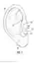 Fig. 05 - Device to enhance an ear bud