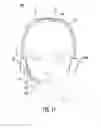 Fig. 09 - Device to enhance an ear bud