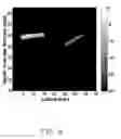 Fig. 07 - CONTRAST IMPROVEMENT METHOD AND SYSTEM FOR PHOTOACOUSTIC IMAGING