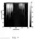 Fig. 08 - CONTRAST IMPROVEMENT METHOD AND SYSTEM FOR PHOTOACOUSTIC IMAGING