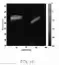 Fig. 11 - CONTRAST IMPROVEMENT METHOD AND SYSTEM FOR PHOTOACOUSTIC IMAGING