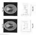 Fig. 30 - Image reconstruction from limited or incomplete data