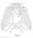Fig. 06 - IMAGE ARTIFACT REDUCTION