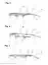 Fig. 04 - Vehicle coupling