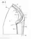 Fig. 04 - Compressor blade and production and use of a compressor blade