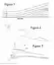 Fig. 02 - AIRFOIL WITH FLOW DEFLECTOR