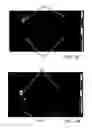 Fig. 02 - Method of imaging localized infections