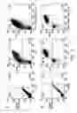 Fig. 07 - Method of imaging localized infections