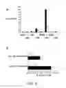 Fig. 09 - Method of imaging localized infections