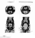 Fig. 02 - Translocator protein ligands
