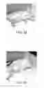 Fig. 14 - METHOD FOR TREATING AND/OR DIAGNOSING TUMOR BY GOLD PARTICLES COATED WITH A POLYMER
