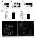 Fig. 01 - Methods and compositions for treating and identifying compounds to treat age-related macular degeneration
