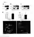 Fig. 02 - Methods and compositions for treating and identifying compounds to treat age-related macular degeneration
