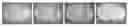 Fig. 01 - Use of functionalized magnetic nanoparticles in cancer detection and treatment