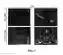 Fig. 09 - STAGED IMMUNE-RESPONSE MODULATION IN ONCOLYTIC THERAPY