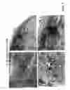 Fig. 11 - STAGED IMMUNE-RESPONSE MODULATION IN ONCOLYTIC THERAPY