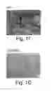 Fig. 03 - METHODS OF TREATING CARDIAC DISORDERS
