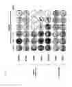 Fig. 06 - Oncolytic virus replicating selectively in tumor cells
