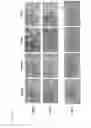 Fig. 07 - Oncolytic virus replicating selectively in tumor cells