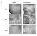 Fig. 01 - METHODS AND COMPOSITIONS FOR TREATING LYMPHOMA AND MYELOMA
