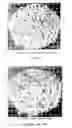 Fig. 02 - Porous biocompatible polymer material and methods