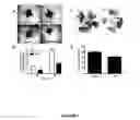 Fig. 02 - ANTI-ANGIOGENESIS, ANTICANCER PROLIFERATION PROPERTIES OF LYMPHOCYTIC-DERIVED MICROPARTICLES