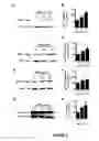 Fig. 06 - ANTI-ANGIOGENESIS, ANTICANCER PROLIFERATION PROPERTIES OF LYMPHOCYTIC-DERIVED MICROPARTICLES