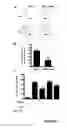Fig. 07 - ANTI-ANGIOGENESIS, ANTICANCER PROLIFERATION PROPERTIES OF LYMPHOCYTIC-DERIVED MICROPARTICLES