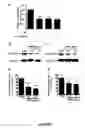 Fig. 08 - ANTI-ANGIOGENESIS, ANTICANCER PROLIFERATION PROPERTIES OF LYMPHOCYTIC-DERIVED MICROPARTICLES