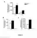 Fig. 09 - ANTI-ANGIOGENESIS, ANTICANCER PROLIFERATION PROPERTIES OF LYMPHOCYTIC-DERIVED MICROPARTICLES