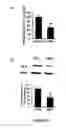 Fig. 32 - ANTI-ANGIOGENESIS, ANTICANCER PROLIFERATION PROPERTIES OF LYMPHOCYTIC-DERIVED MICROPARTICLES