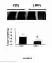 Fig. 33 - ANTI-ANGIOGENESIS, ANTICANCER PROLIFERATION PROPERTIES OF LYMPHOCYTIC-DERIVED MICROPARTICLES