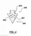 Fig. 05 - Injection Molding Nozzle Having A Nozzle Tip With Diamond Crown