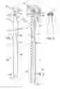 Fig. 02 - Dental prosthesis removal tool