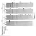 Fig. 02 - METHODS AND COMPOSITIONS FOR IDENTIFICATION OF PROSTATE CANCER MARKERS