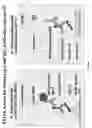 Fig. 45 - Method for determining the risk of crohn's disease-related complications