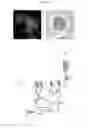 Fig. 02 - SCREENING METHODS FOR IDENTIFYING TARGET ANTIFUNGAL GENES AND COMPOUNDS BY DETECTING CELL SURFACE GLYCOPROTEINS