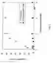 Fig. 04 - Method of detecting target molecule by using aptamer