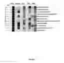 Fig. 04 - ST2-BASED DENGUE FEVER DIAGNOSTIC