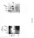 Fig. 13 - Infectivity-enhanced conditionally-replicative adenovirus and uses thereof