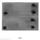 Fig. 06 - Method for detecting a target molecule in a biological sample