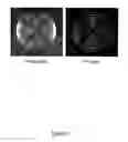 Fig. 63 - Methods for the Detection of Colorectal Cancer