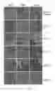 Fig. 03 - Multipurpose Lens Care Solution with Benefits to Corneal Epithelial Barrier Function