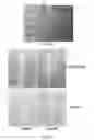 Fig. 02 - Bone Morphogenetic Proteins for Appetite Control