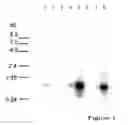 Fig. 02 - Therapeutic agent for diabetes