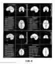 Fig. 06 - TREATMENT OF IMPULSE CONTROL DISORDERS