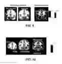 Fig. 07 - TREATMENT OF IMPULSE CONTROL DISORDERS