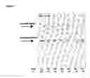 Fig. 03 - Use of antisense oligonucleotides to effect translation modulation