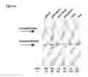 Fig. 05 - Use of antisense oligonucleotides to effect translation modulation